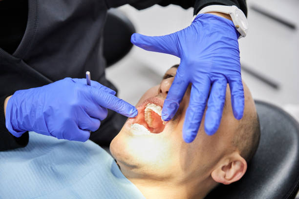 Best Dental Abscess Treatment in Hartsville, SC